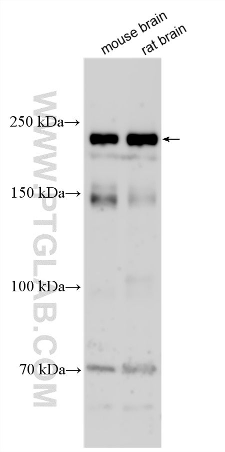 Western Blot (WB) analysis of various lysates using PLXNA4 Polyclonal antibody (17201-1-AP)