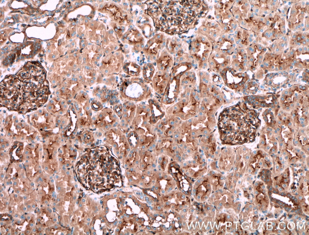 Immunohistochemistry (IHC) staining of human kidney tissue using PLXNB1 Polyclonal antibody (23795-1-AP)