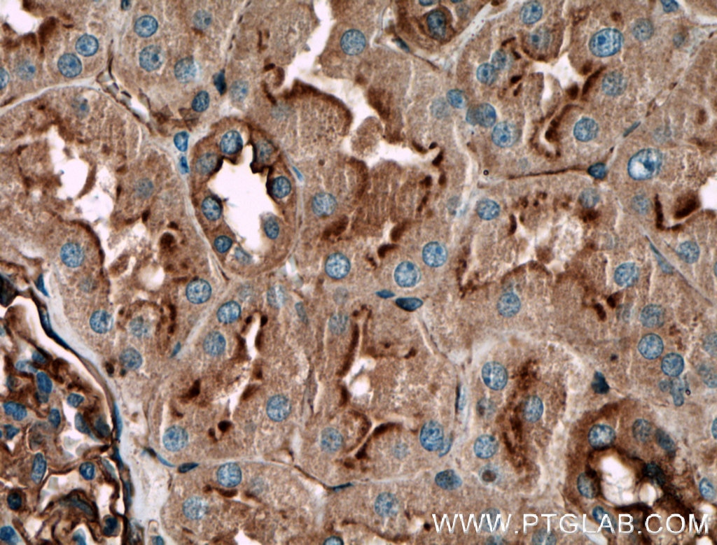 Immunohistochemistry (IHC) staining of human kidney tissue using PLXNB1 Polyclonal antibody (23795-1-AP)