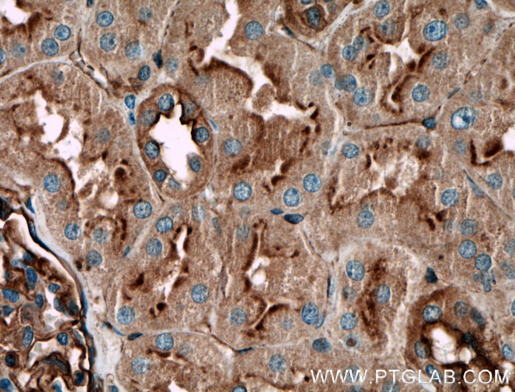 Immunohistochemistry (IHC) staining of human kidney tissue using PLXNB1 Polyclonal antibody (23795-1-AP)