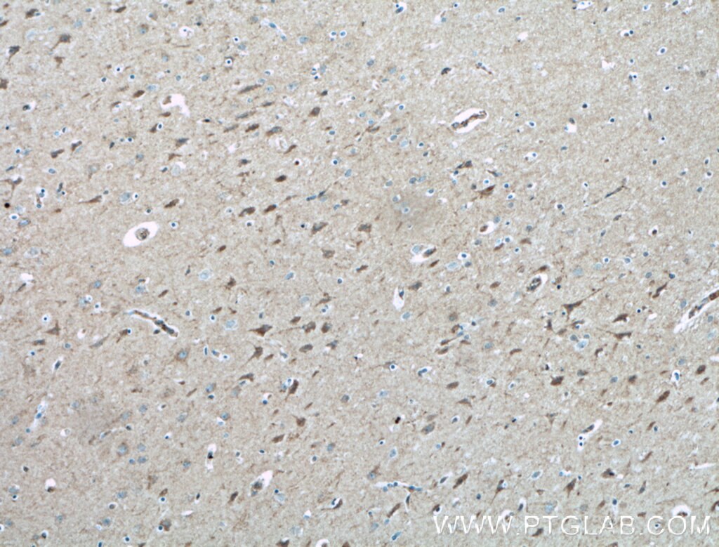 Immunohistochemistry (IHC) staining of human brain tissue using PLXNB1 Polyclonal antibody (23795-1-AP)