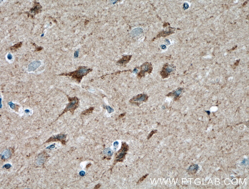 Immunohistochemistry (IHC) staining of human brain tissue using PLXNB1 Polyclonal antibody (23795-1-AP)