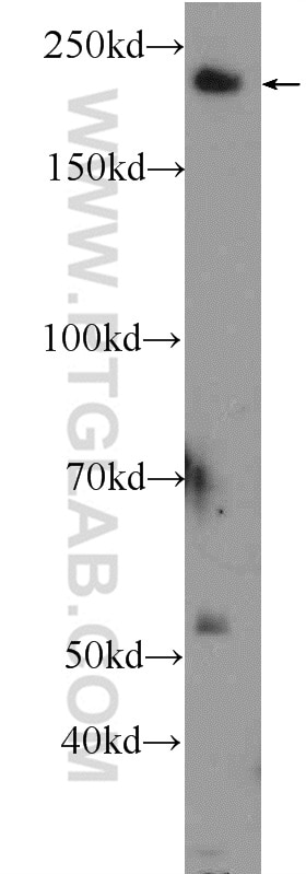 WB analysis of mouse brain using 23795-1-AP