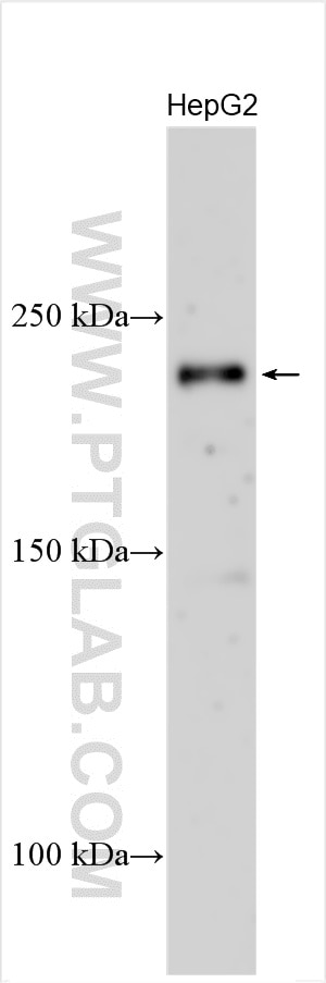 Western Blot (WB) analysis of various lysates using Plexin B1 Polyclonal antibody (23795-1-AP)