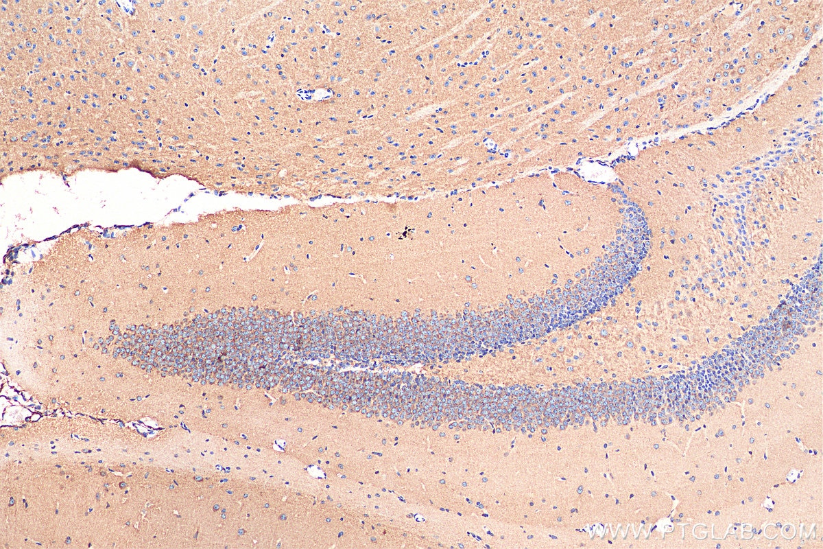 Immunohistochemistry (IHC) staining of mouse brain tissue using PLXNB1 Polyclonal antibody (29440-1-AP)