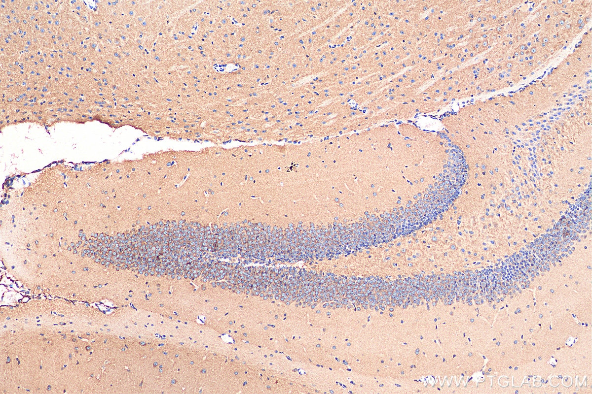 Immunohistochemistry (IHC) staining of mouse brain tissue using PLXNB1 Polyclonal antibody (29440-1-AP)