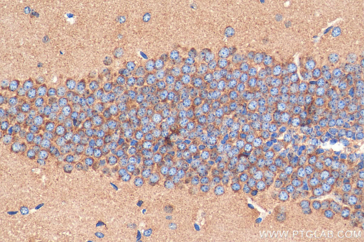 Immunohistochemistry (IHC) staining of mouse brain tissue using PLXNB1 Polyclonal antibody (29440-1-AP)
