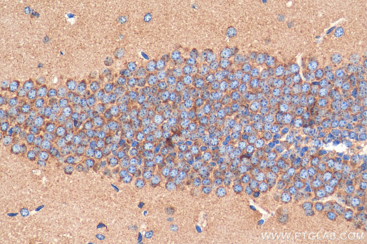 Immunohistochemistry (IHC) staining of mouse brain tissue using PLXNB1 Polyclonal antibody (29440-1-AP)