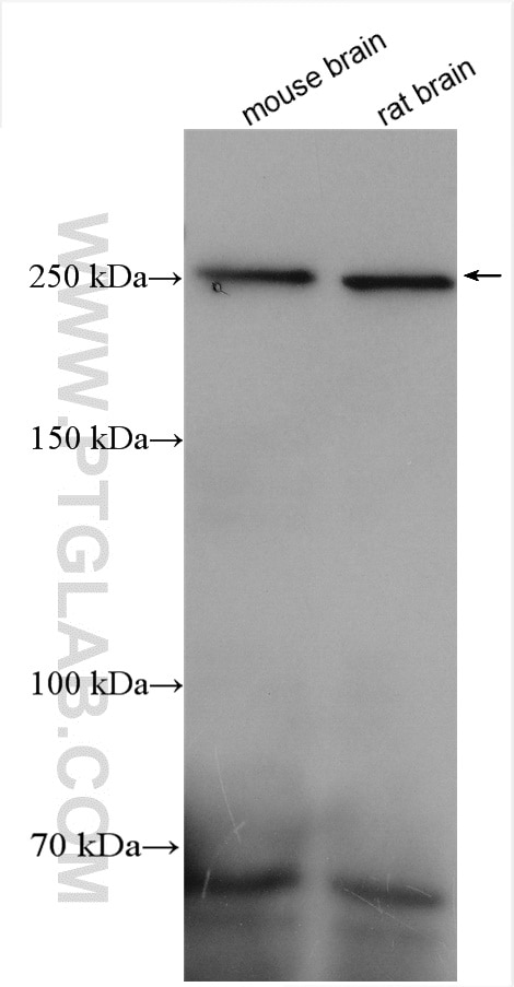 Western Blot (WB) analysis of various lysates using PLXNB1 Polyclonal antibody (29440-1-AP)