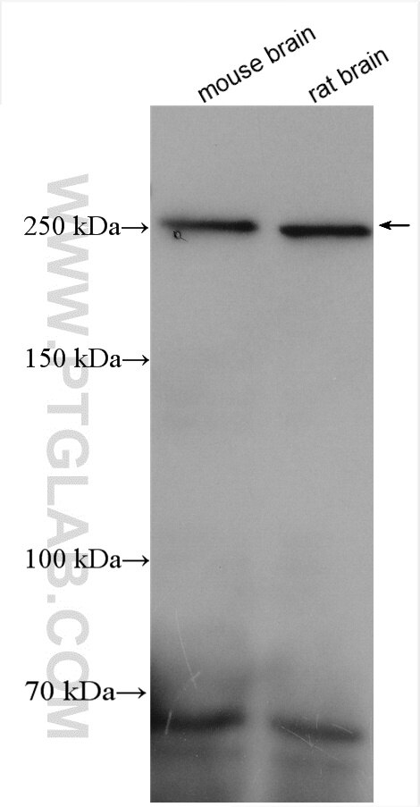 Western Blot (WB) analysis of various lysates using PLXNB1 Polyclonal antibody (29440-1-AP)