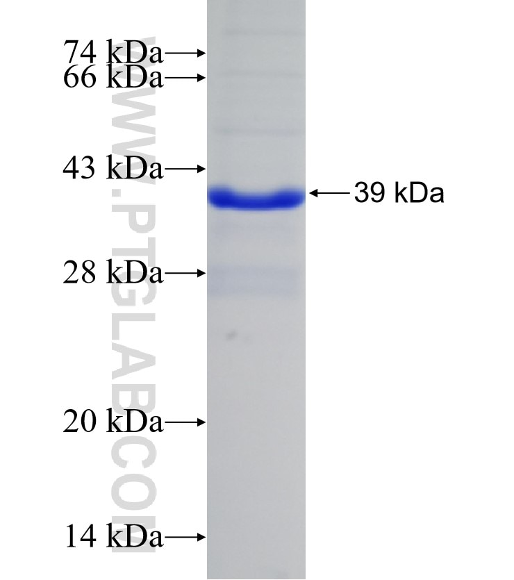 PLXNB1 fusion protein Ag31224 SDS-PAGE