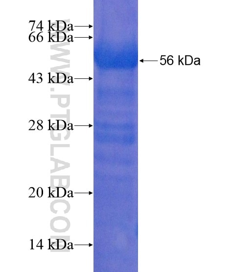 PLXNB1 fusion protein Ag20719 SDS-PAGE