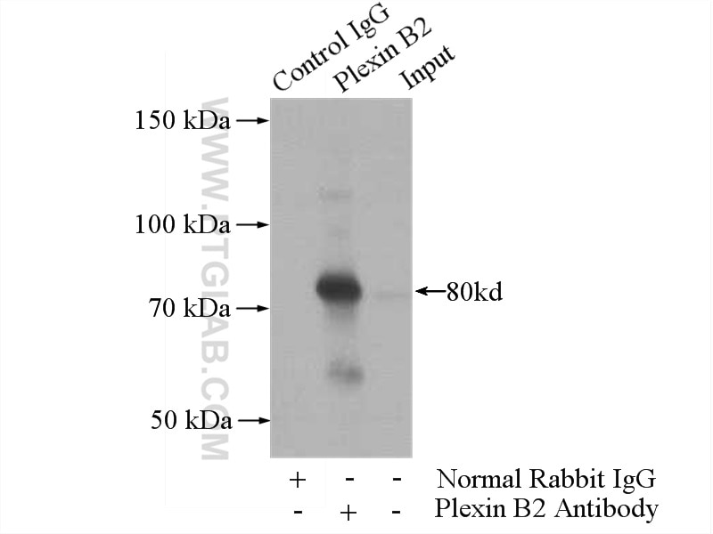 Immunoprecipitation (IP) experiment of mouse liver tissue using Plexin B2 Polyclonal antibody (10602-1-AP)