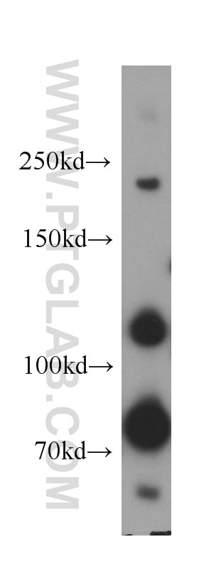 Western Blot (WB) analysis of human brain tissue using Plexin B2 Polyclonal antibody (10602-1-AP)