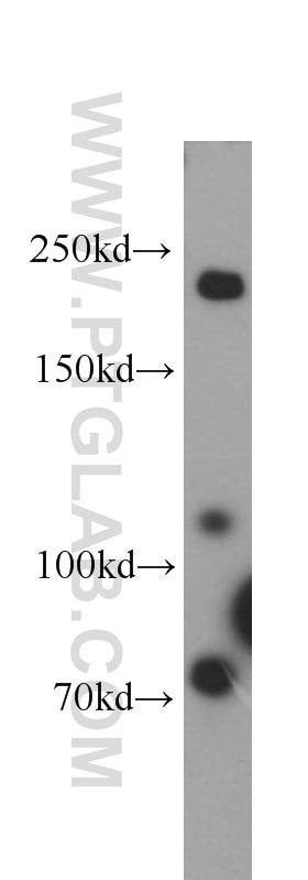 Western Blot (WB) analysis of HEK-293 cells using Plexin B2 Polyclonal antibody (10602-1-AP)