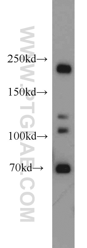Western Blot (WB) analysis of HeLa cells using Plexin B2 Polyclonal antibody (10602-1-AP)