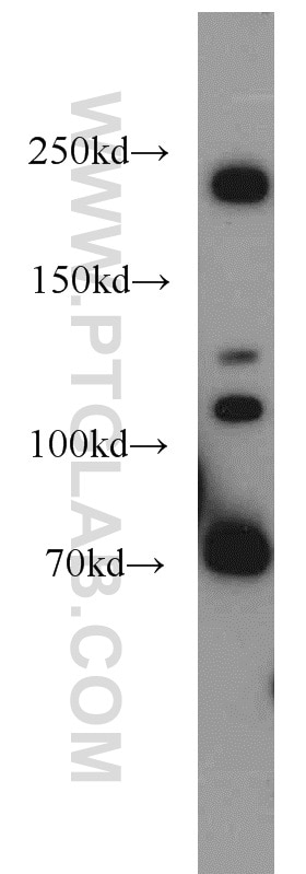 Western Blot (WB) analysis of MCF-7 cells using Plexin B2 Polyclonal antibody (10602-1-AP)