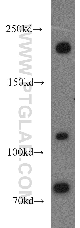 Western Blot (WB) analysis of A549 cells using Plexin B2 Polyclonal antibody (10602-1-AP)