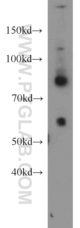 Western Blot (WB) analysis of mouse liver tissue using Plexin B2 Polyclonal antibody (10602-1-AP)