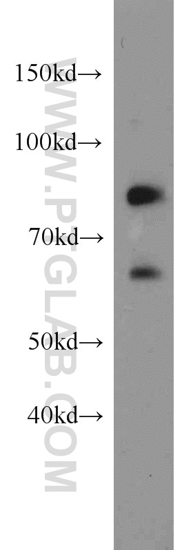 Western Blot (WB) analysis of mouse ovary tissue using Plexin B2 Polyclonal antibody (10602-1-AP)
