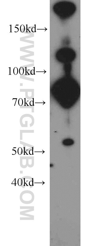 WB analysis of HepG2 using 10602-1-AP