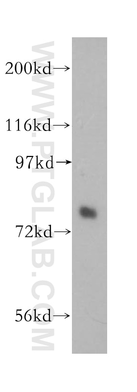 Western Blot (WB) analysis of human brain tissue using Plexin B2 Polyclonal antibody (10602-1-AP)