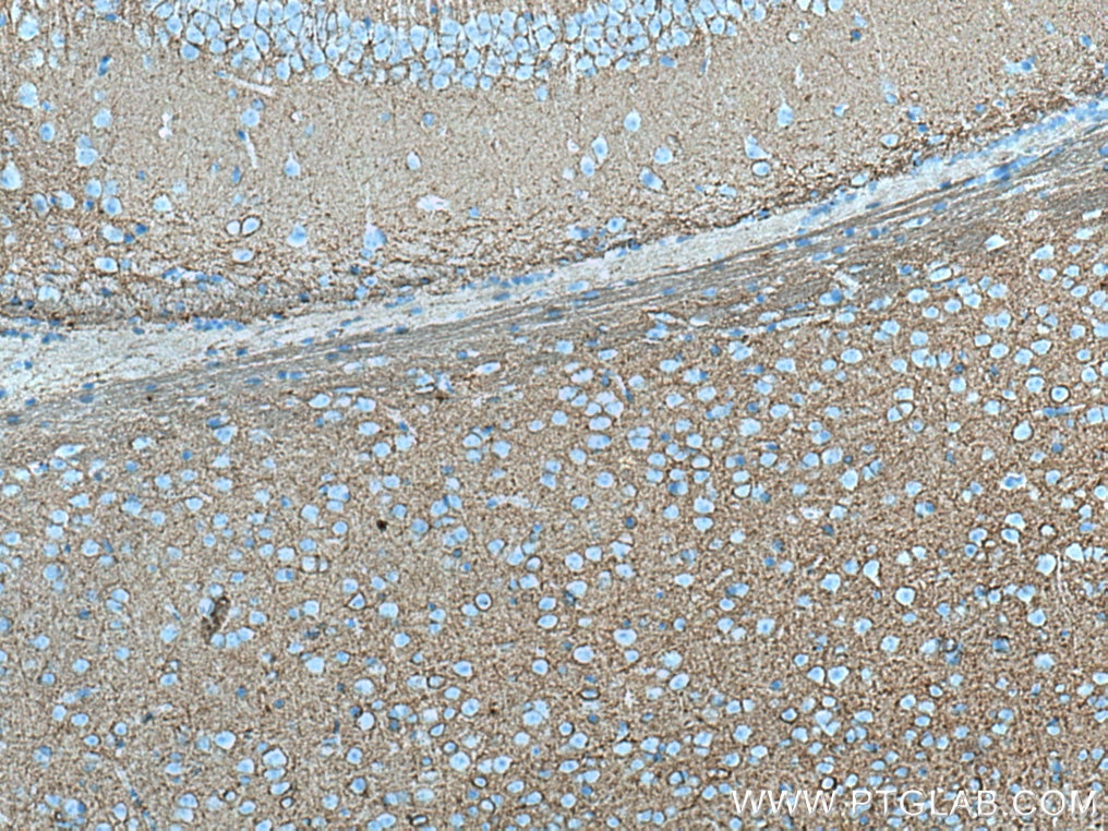 Immunohistochemistry (IHC) staining of mouse brain tissue using PLXNB2 Monoclonal antibody (67265-1-Ig)