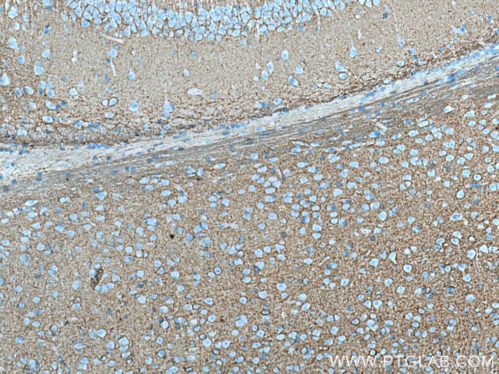 Immunohistochemistry (IHC) staining of mouse brain tissue using PLXNB2 Monoclonal antibody (67265-1-Ig)