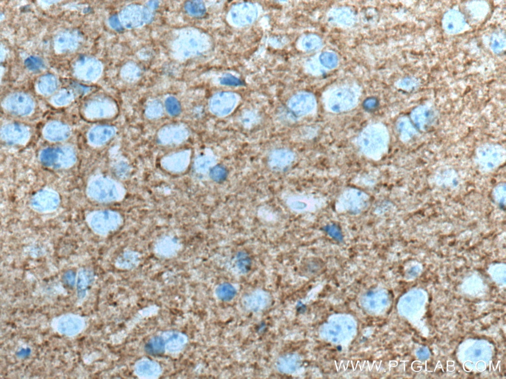 IHC staining of mouse brain using 67265-1-Ig
