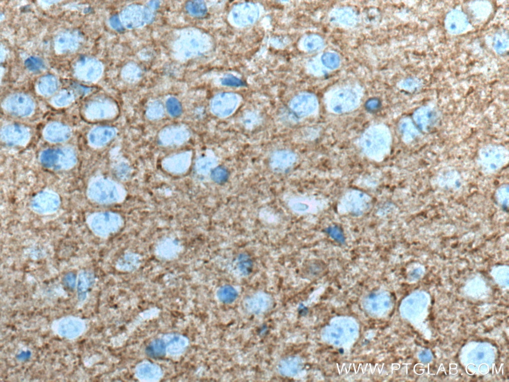 Immunohistochemistry (IHC) staining of mouse brain tissue using PLXNB2 Monoclonal antibody (67265-1-Ig)