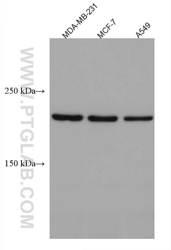 Western Blot (WB) analysis of various lysates using PLXNB2 Monoclonal antibody (67265-1-Ig)