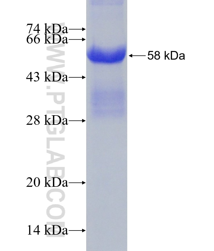 PLXNB2 fusion protein Ag28706 SDS-PAGE