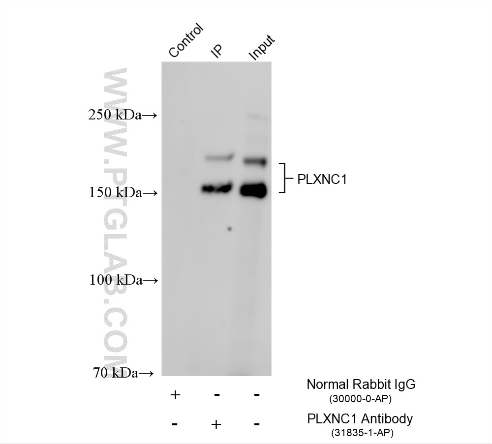 IP experiment of mouse brain using 31835-1-AP Immunoprecipitation (IP) experiment of mouse brain tissue using PLXNC1 Polyclonal antibody (31835-1-AP)