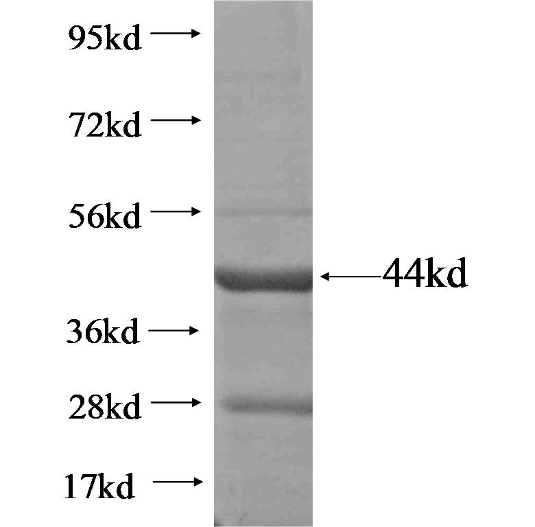 PLXNC1 fusion protein Ag18170 SDS-PAGE