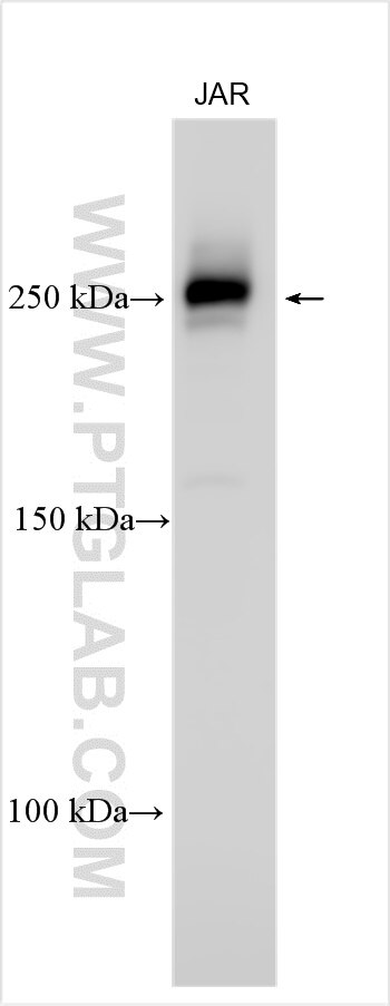 Western Blot (WB) analysis of various lysates using PLXND1 Polyclonal antibody (32470-1-AP)