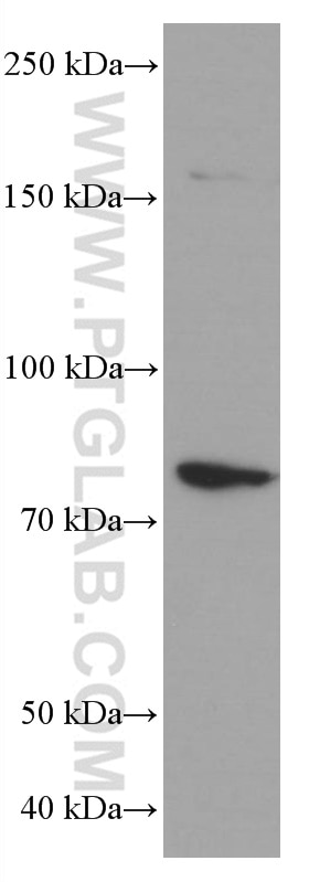 Western Blot (WB) analysis of HeLa cells using PLZF Monoclonal antibody (66672-1-Ig)