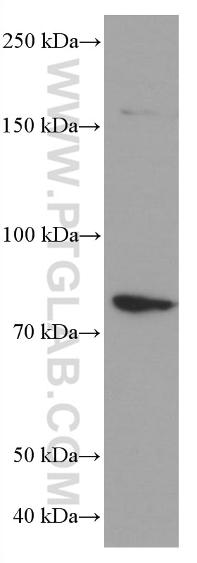 WB analysis of HeLa using 66672-1-Ig