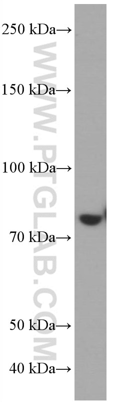 Western Blot (WB) analysis of THP-1 cells using PLZF Monoclonal antibody (66672-1-Ig)