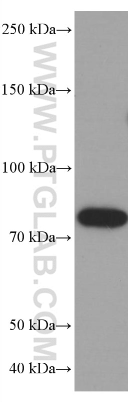 Western Blot (WB) analysis of Ramos cells using PLZF Monoclonal antibody (66672-1-Ig)