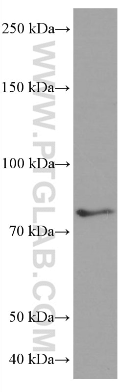 Western Blot (WB) analysis of human testis tissue using PLZF Monoclonal antibody (66672-1-Ig)