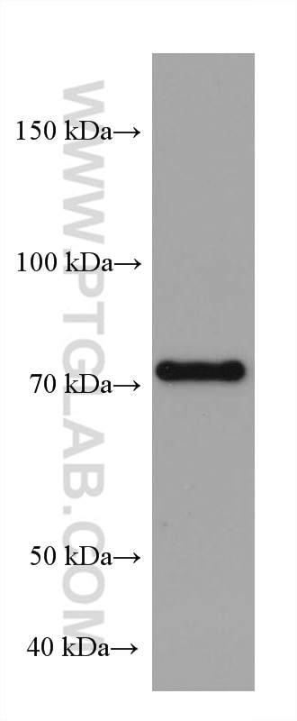 Western Blot (WB) analysis of Ramos cells using PLZF Monoclonal antibody (66672-1-Ig)