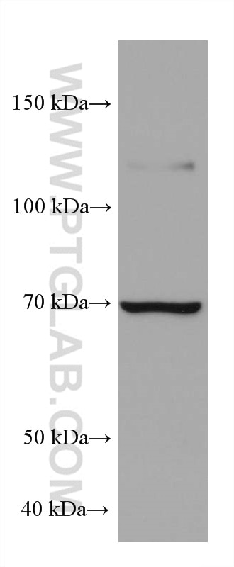 Western Blot (WB) analysis of Raji cells using PLZF Monoclonal antibody (66672-1-Ig)