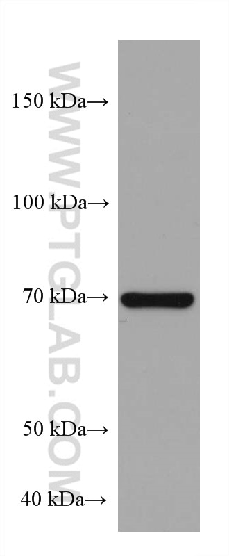 WB analysis of Daudi using 66672-1-Ig