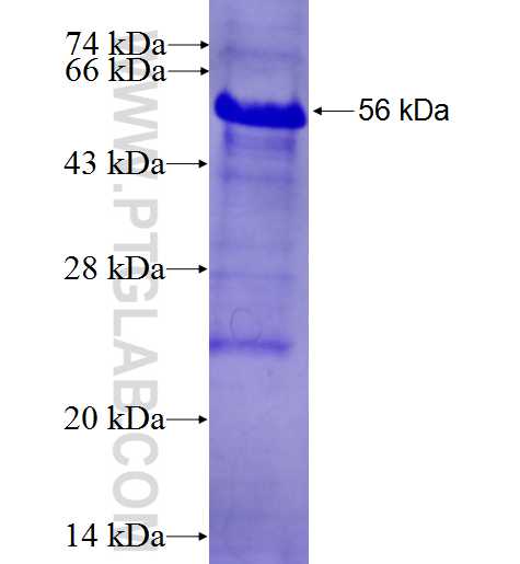 PLZF fusion protein Ag25180 SDS-PAGE