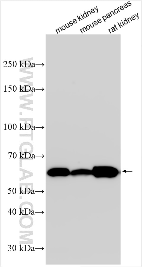 Western Blot (WB) analysis of various lysates using PM20D1 Polyclonal antibody (30577-1-AP)