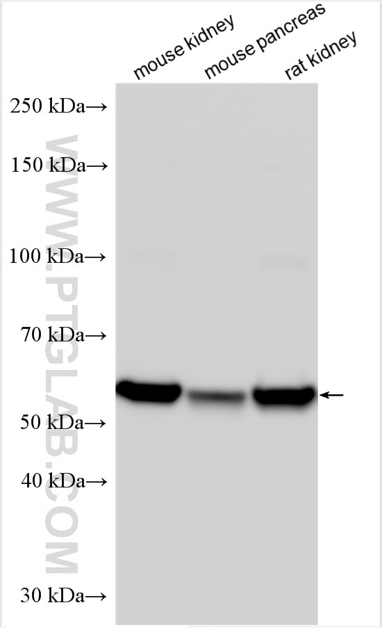 Western Blot (WB) analysis of various lysates using PM20D1 Polyclonal antibody (30577-1-AP)