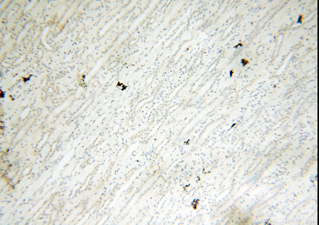 Immunohistochemistry (IHC) staining of human kidney tissue using PM20D2 Polyclonal antibody (17705-1-AP)