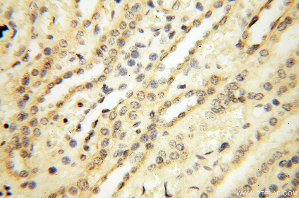 Immunohistochemistry (IHC) staining of human kidney tissue using PM20D2 Polyclonal antibody (17705-1-AP)