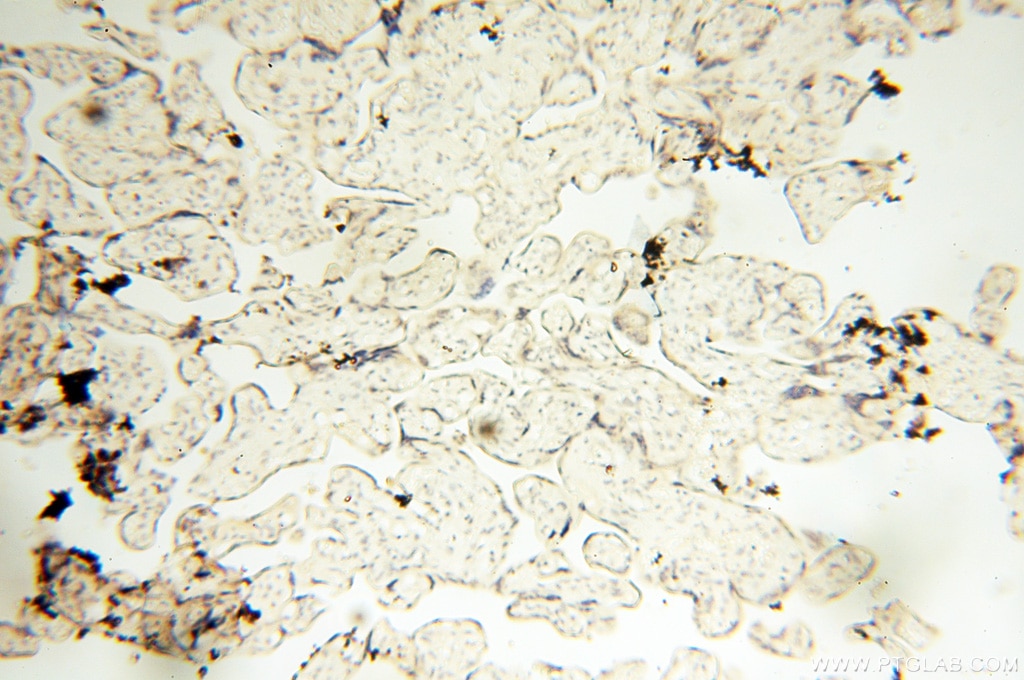 Immunohistochemistry (IHC) staining of human placenta tissue using PM20D2 Polyclonal antibody (17705-1-AP)