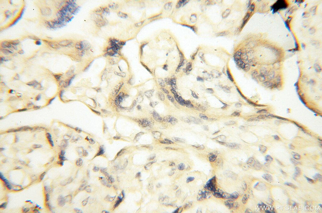 Immunohistochemistry (IHC) staining of human placenta tissue using PM20D2 Polyclonal antibody (17705-1-AP)